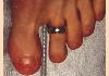 mytoes3.jpg