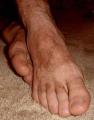 bsx-hairy01.jpg