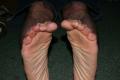 footlink-3.JPG