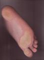 09_my_feets_011.jpg