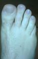 38_1_wes_toes_1_1_1.jpg